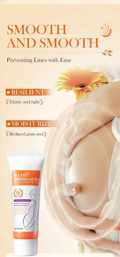 Stretch Marks Removal Cream
