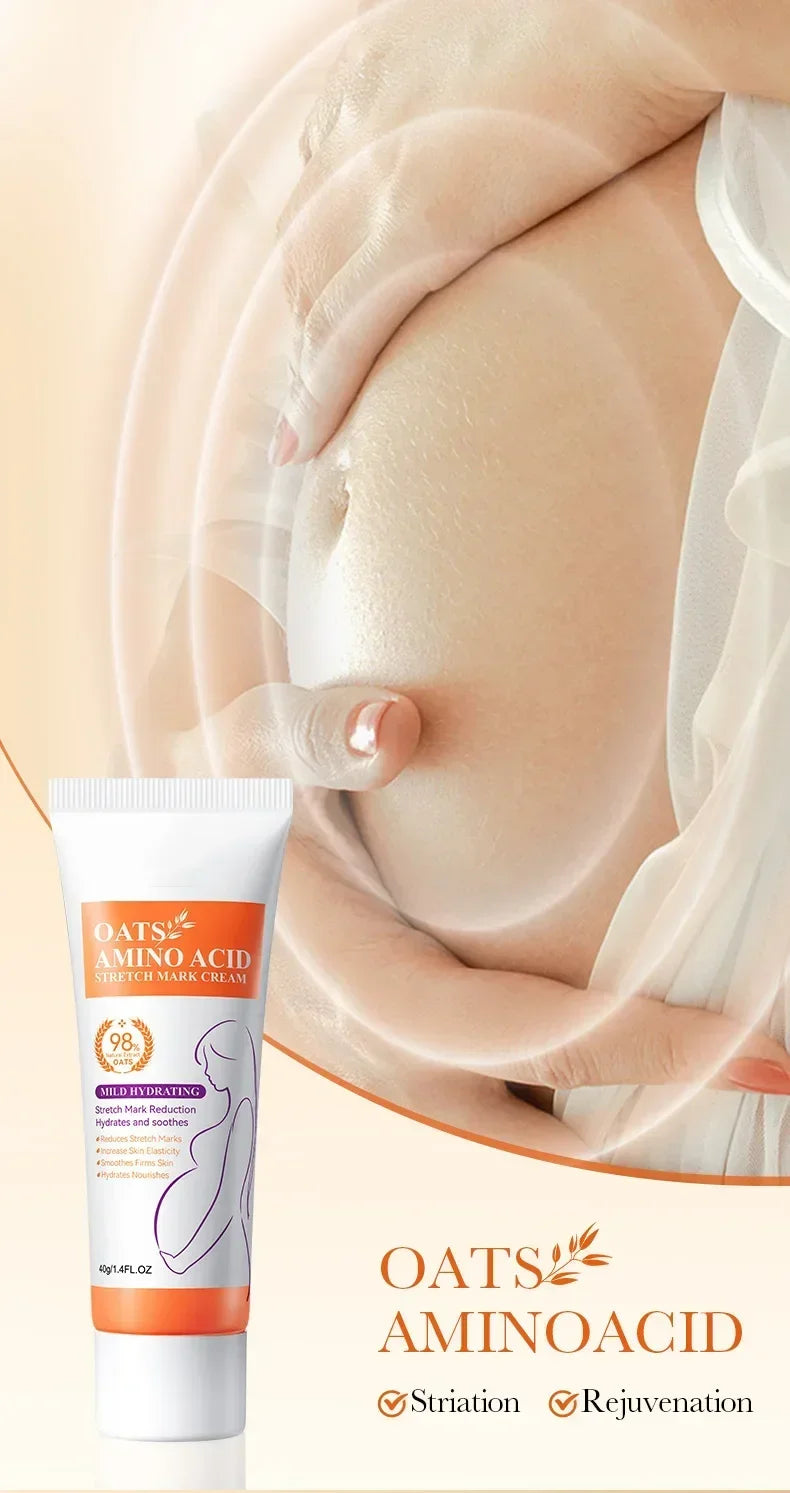 Stretch Marks Removal Cream