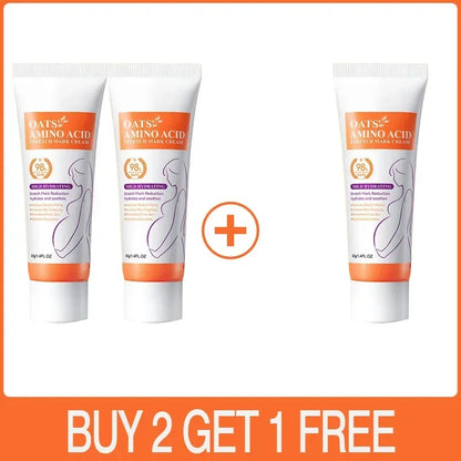 Stretch Marks Removal Cream