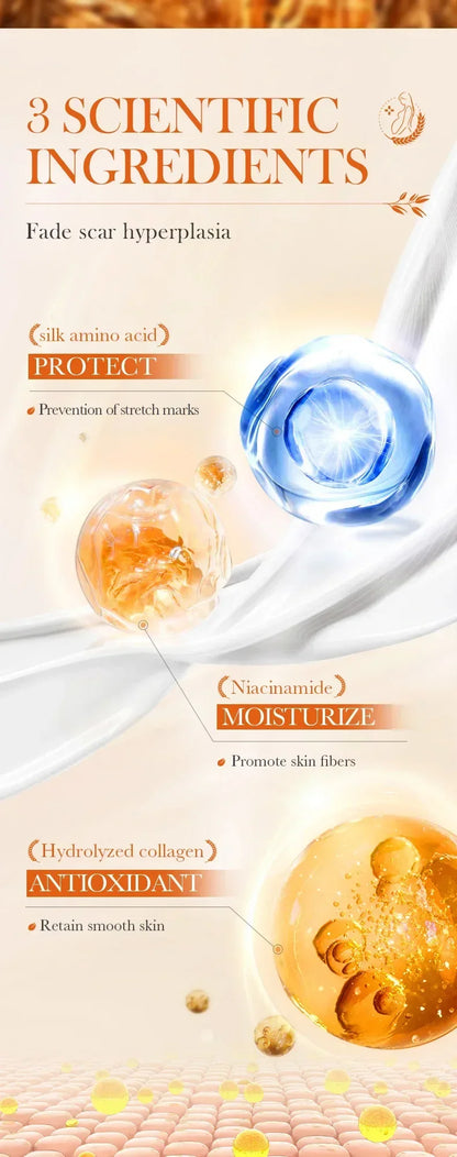 Stretch Marks Removal Cream
