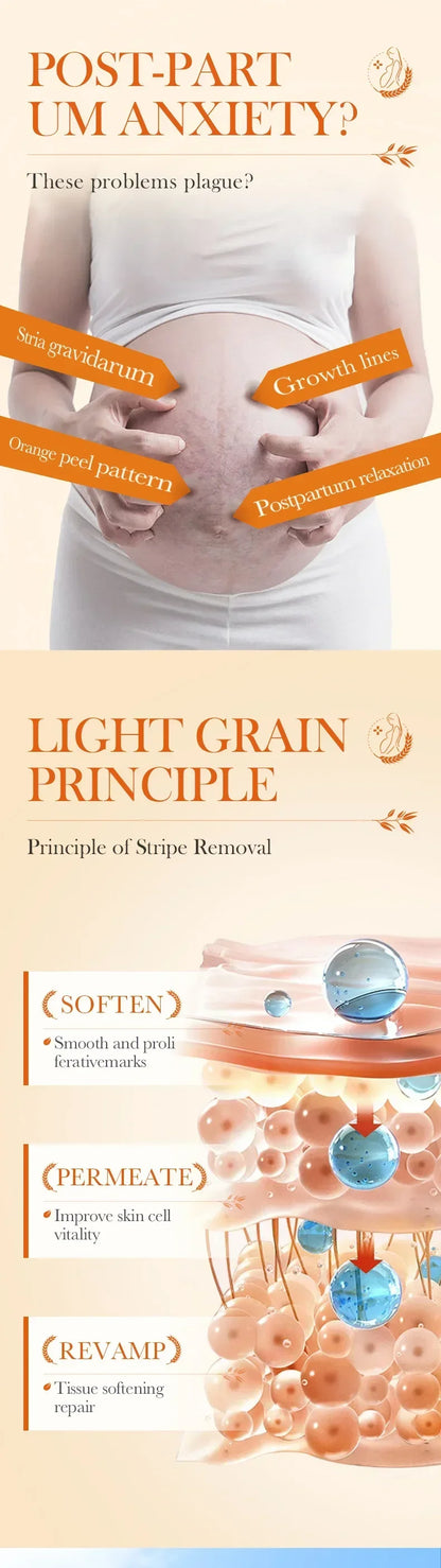 Stretch Marks Removal Cream