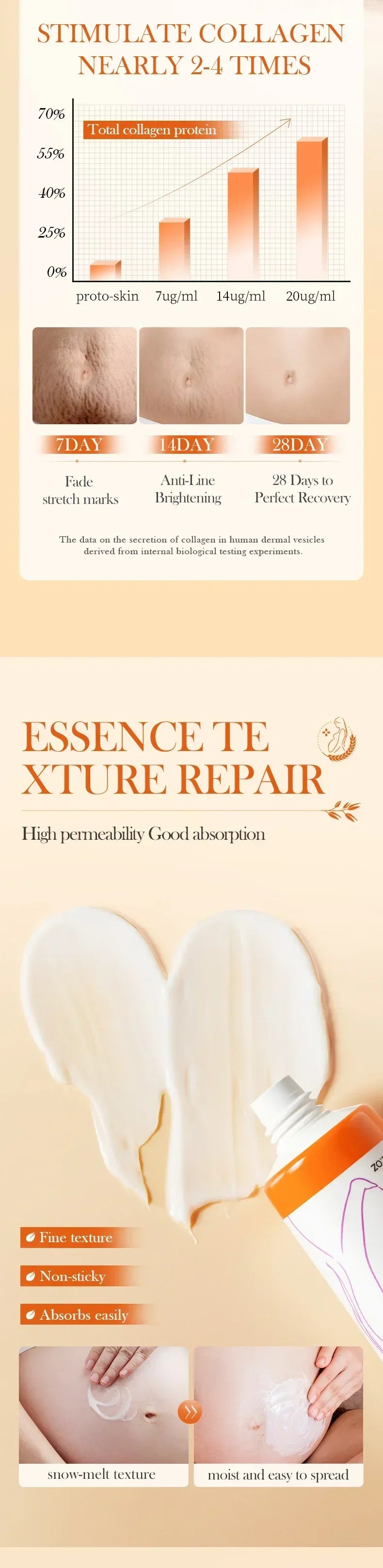 Stretch Marks Removal Cream