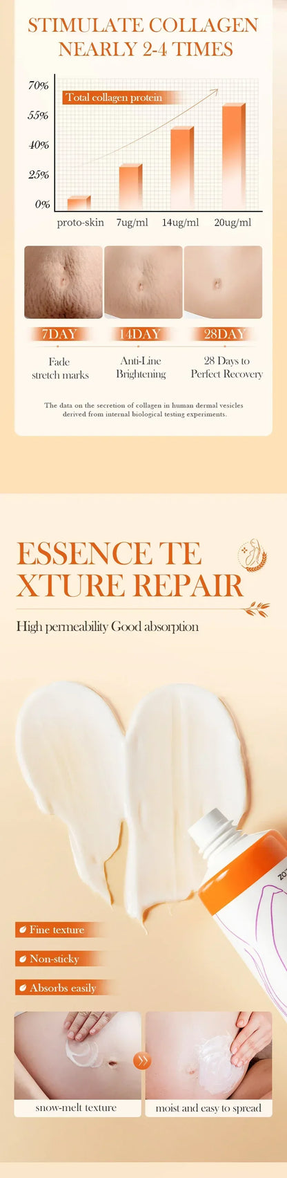 Stretch Marks Removal Cream
