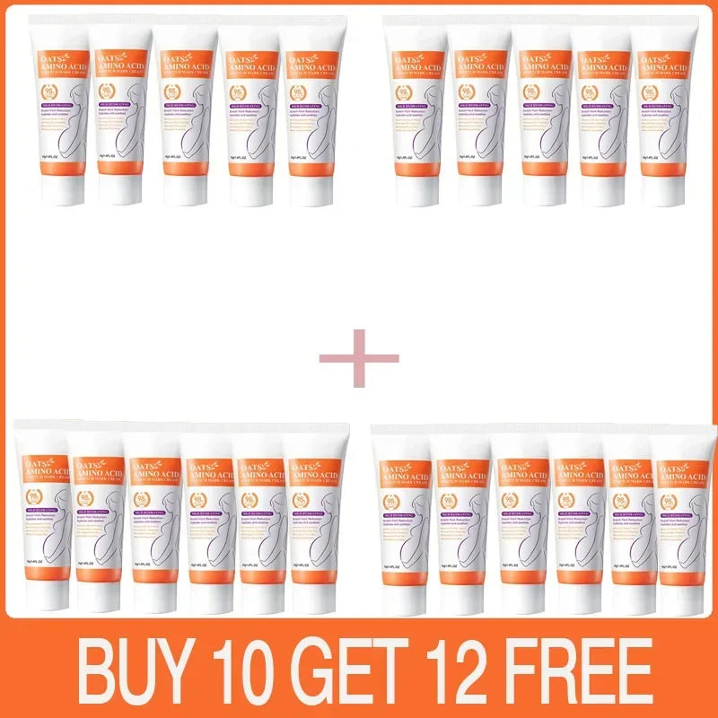 Stretch Marks Removal Cream