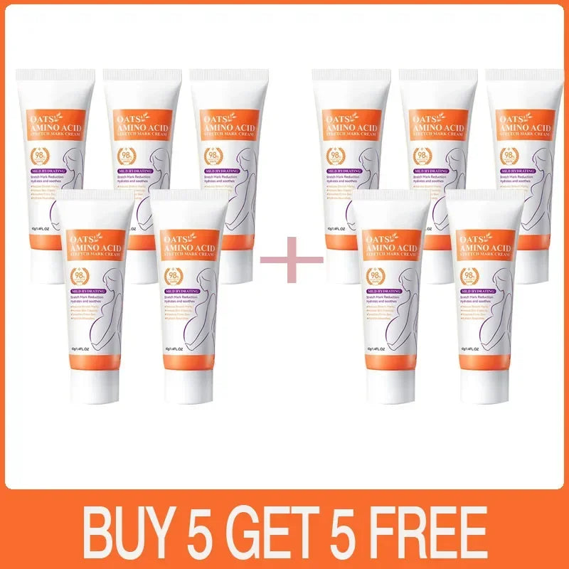 Stretch Marks Removal Cream