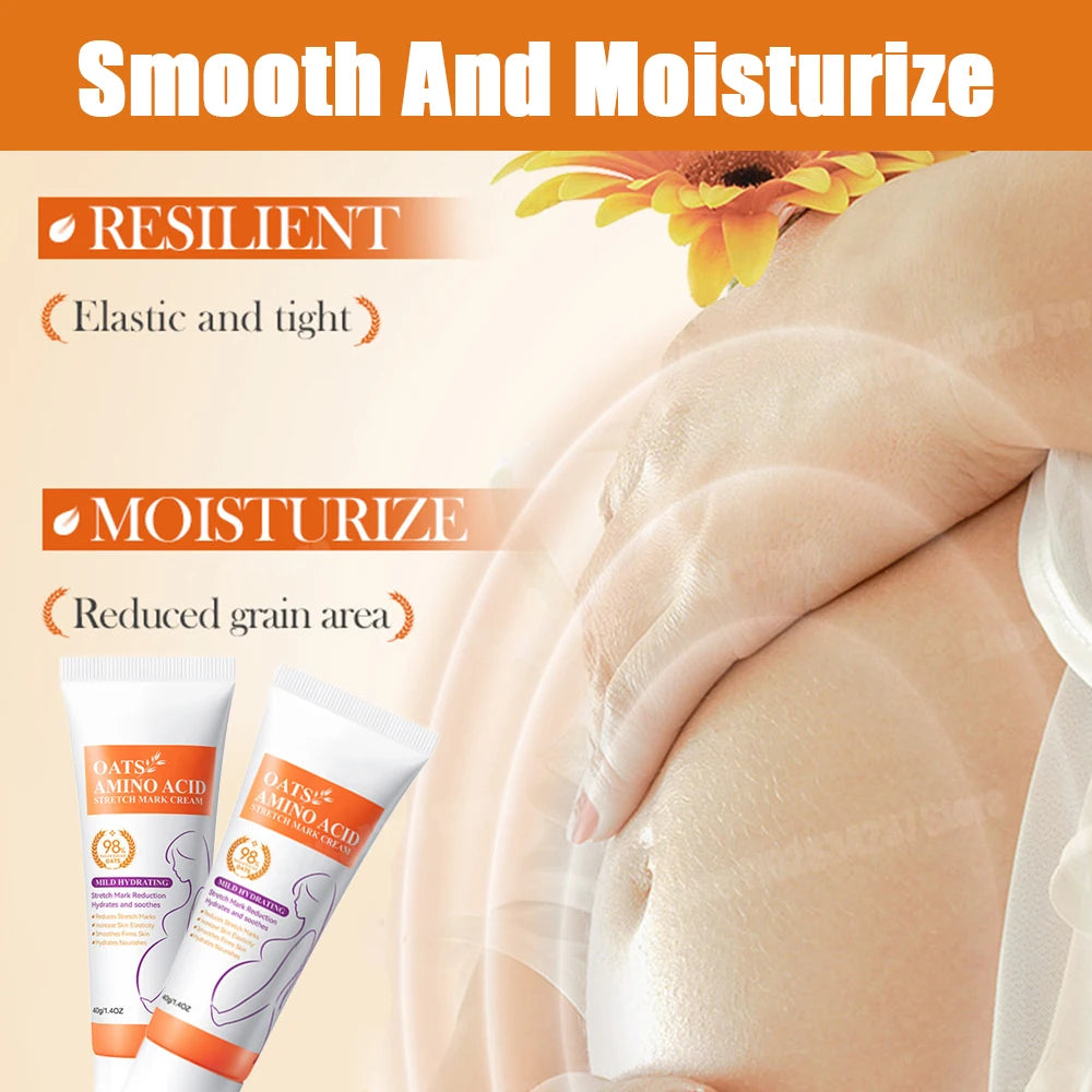 Stretch Marks Removal Cream